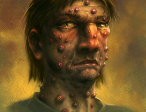 RPG – Bubbonic Spell